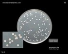 Escherichia coli on Mueller Hinton agar